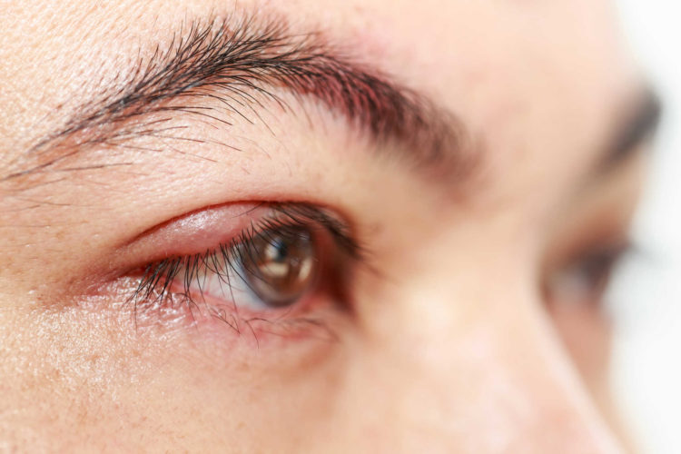 7 nguyên nhân gây ngứa khóe mắt (nhiều người mắc phải)