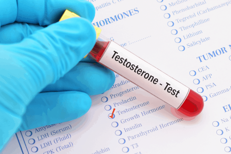 Xét nghiệm testosterone là gì?